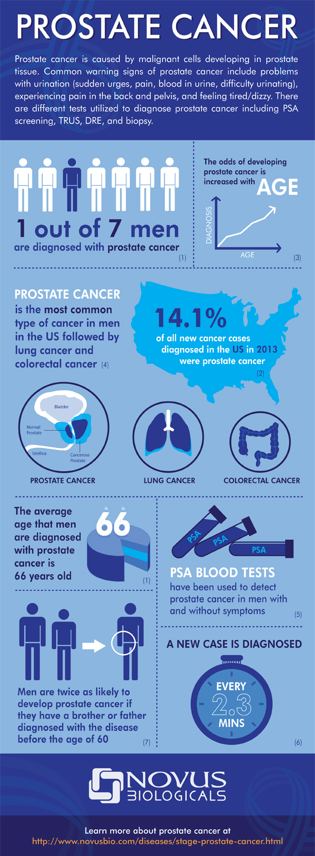 Prostrate Cancer Facts